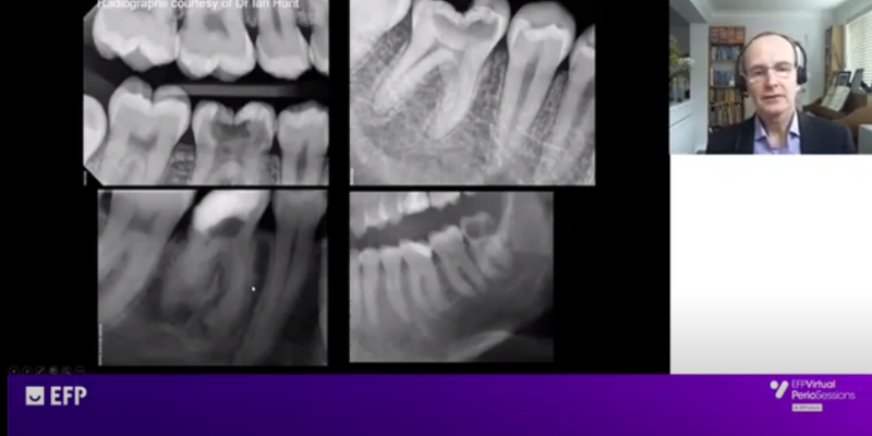 Ian Needleman explains relationship between oral health and sports performance in elite athletes