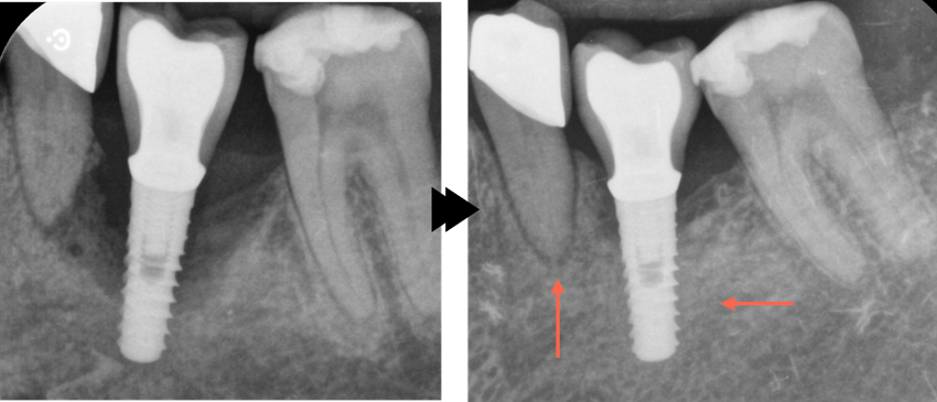 Clinical image