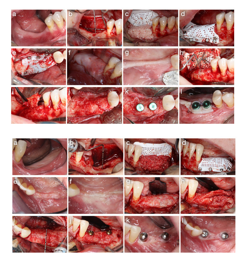 clinical photographs comparing procedures