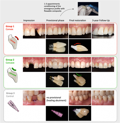 Figure showing study workflow
