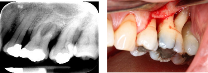 radiograph and photo