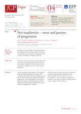 Peri-implantitis – onset and pattern of progression